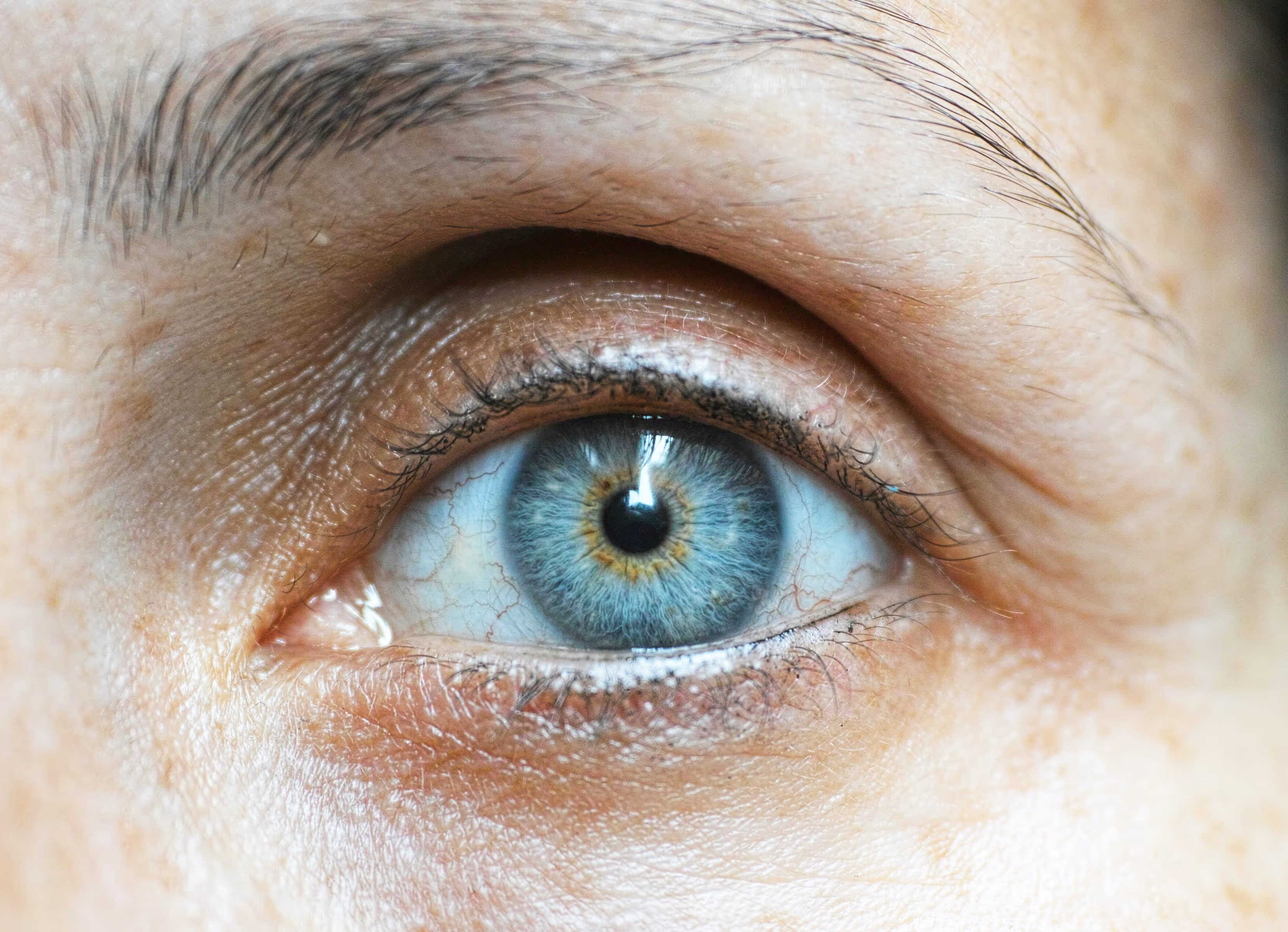 Tear Trough & Under-Eye